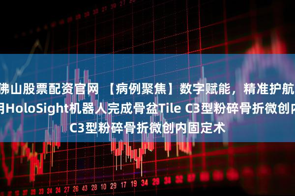 佛山股票配资官网 【病例聚焦】数字赋能，精准护航 医院应用HoloSight机器人完成骨盆Tile C3型粉碎骨折微创内固定术